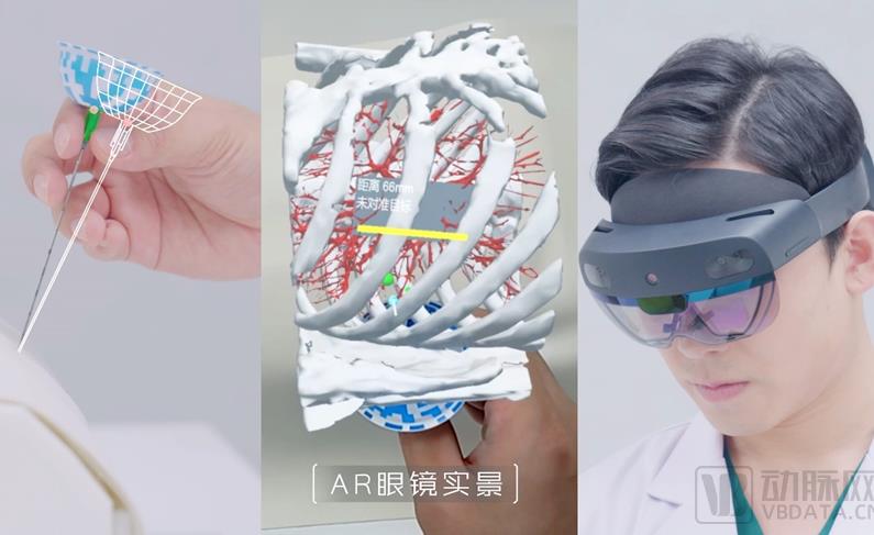20230710091031_9287_795x487